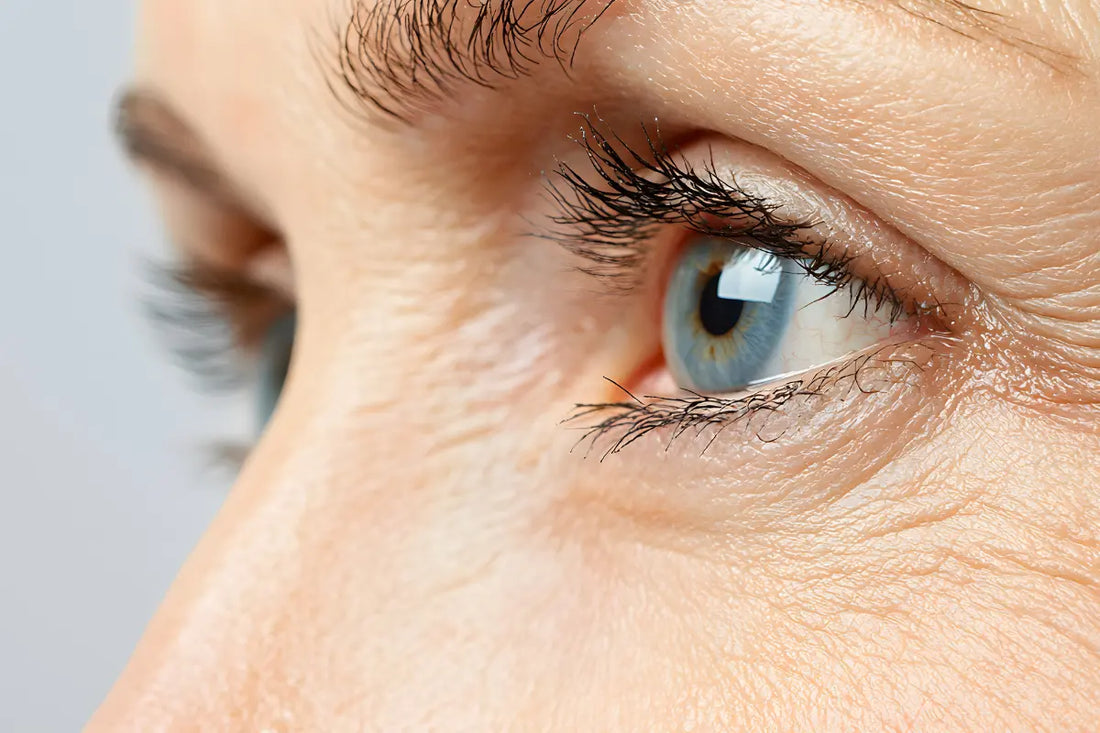 Come ridurre le rughe sotto gli occhi: rimedi e consigli per il contorno occhi